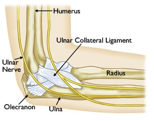 An increasingly common injury